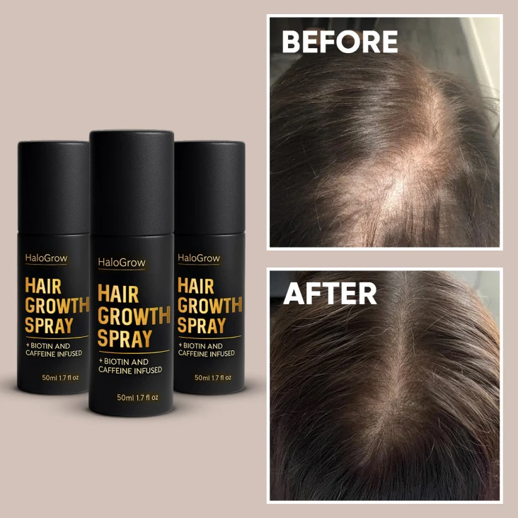Who HaloGrow is suitable for – different causes of hair loss